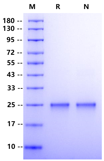 KRAS His Tag Protein, Human