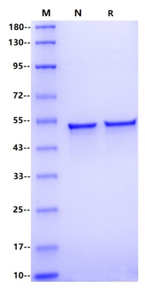 Nucleocapsid His Tag, SARS-CoV-2