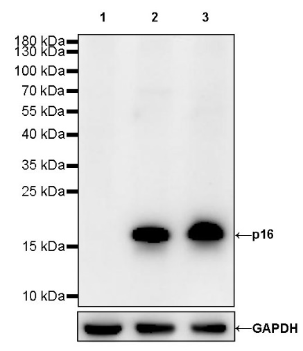 p16 Recombinant Rabbit mAb (S-303-1)