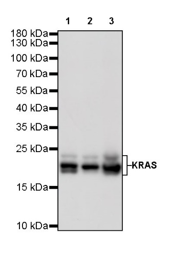 KRAS Recombinant Rabbit mAb (S-R291)