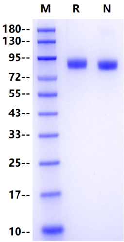 G-CSFR/CD114 His Tag Protein, Human