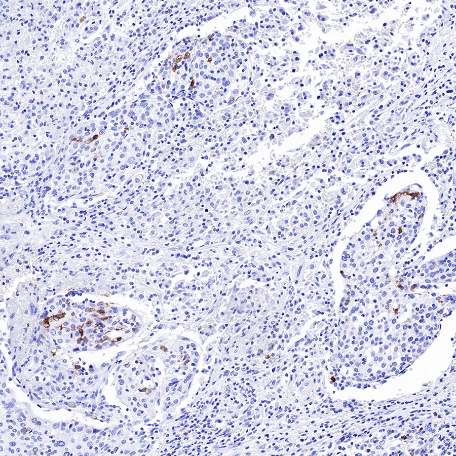 CD1A Recombinant Rabbit mAb (SDT-R086)