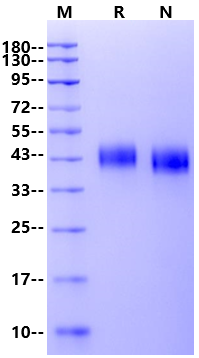 MXRA8/DICAM His Tag Protein, Human