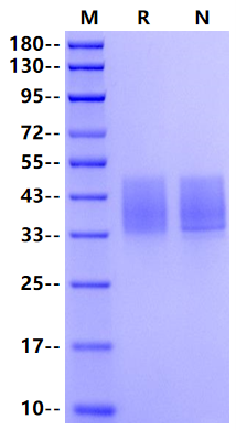 IL10RB His Tag Protein, Human