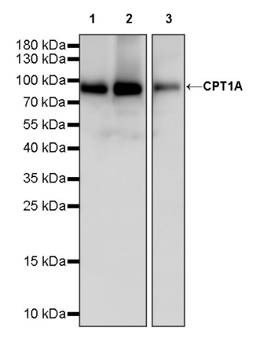 CPT1A Recombinant Rabbit mAb (S-1263-2)