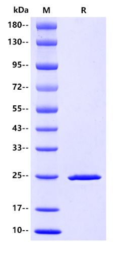 HIV (HIV1-HXB2) P24 Protein, His tag