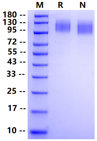 Biotinylated CEACAM-5/CD66e His&Avi Tag Protein, Human