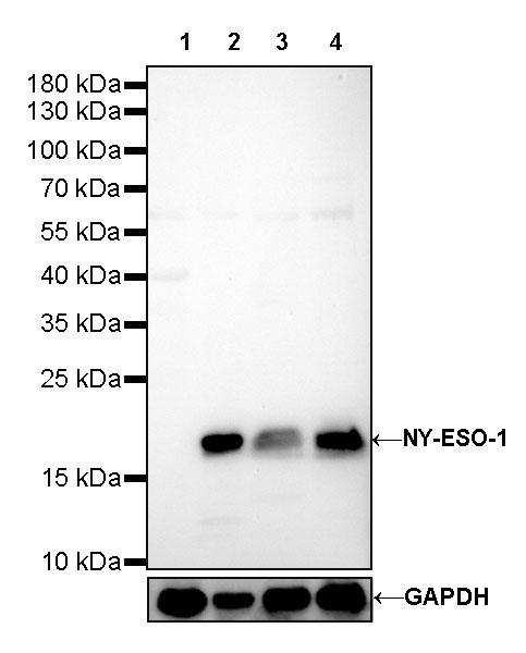 NY-ESO-1 Recombinant Rabbit mAb (SDT-R154)