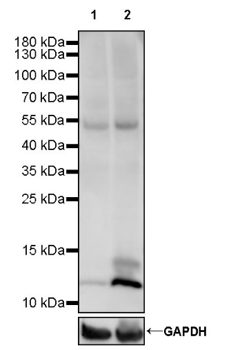 Butyryllysine Recombinant Rabbit mAb (S-R399)