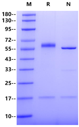PCSK9 His Tag Protein, Mouse