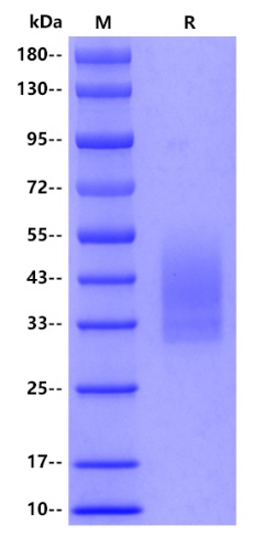 Mouse PSD95 Protein, His tag