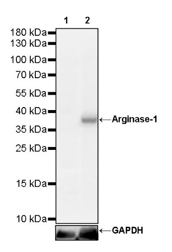 Arginase-1 Recombinant Rabbit mAb (SDT-369-33)