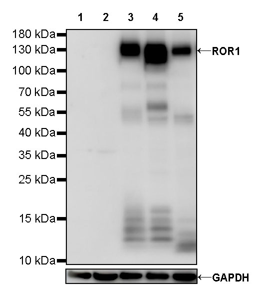 ROR1 Recombinant Rabbit mAb (SDT-R501-148)