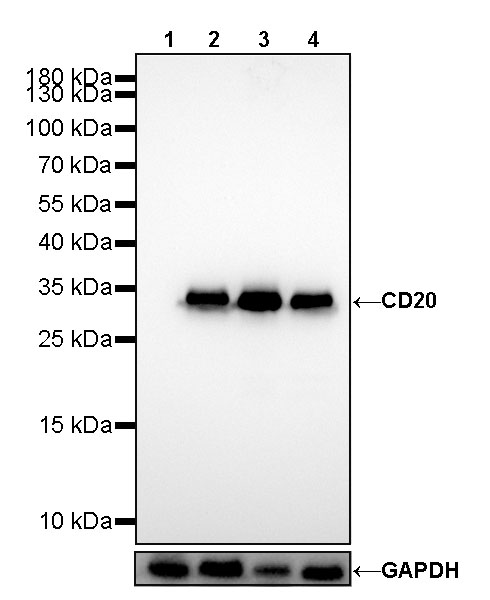 S-RMab® CD20 Recombinant Rabbit mAb (SDT-R133)