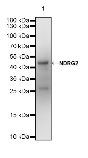 NDRG2 Recombinant Rabbit mAb (S-618-76)
