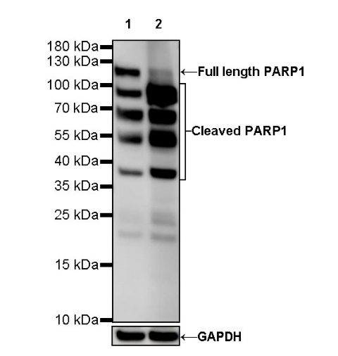 PARP1 Recombinant Rabbit mAb (S-R299)