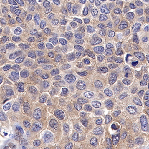 PTP1B Recombinant Rabbit mAb (S-R304)