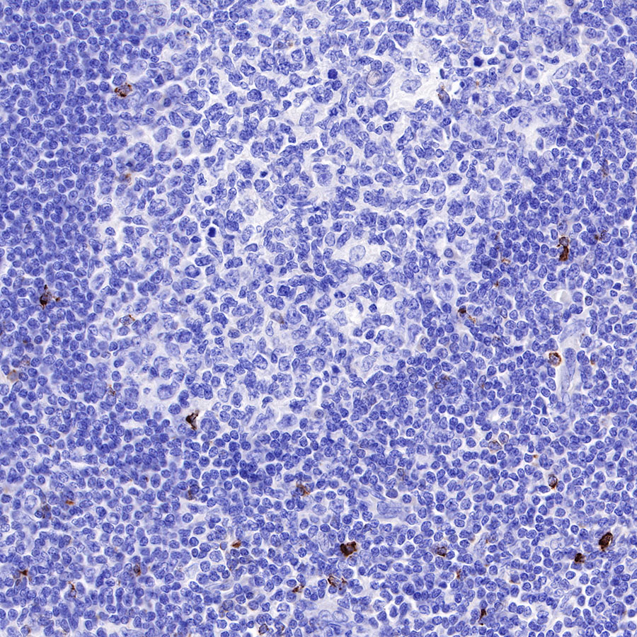 LAG3 Recombinant Rabbit mAb (SDT-R159)