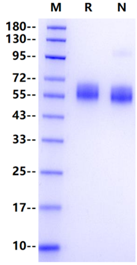 IL1RL1/ST2 His Tag Protein, Human