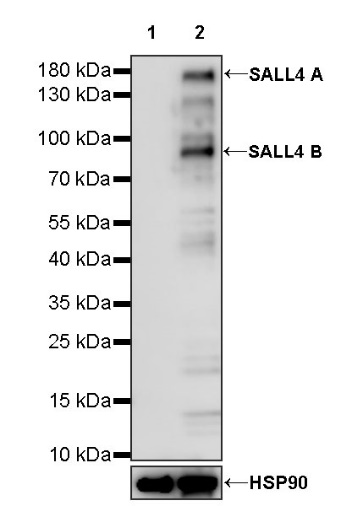 SALL4 Recombinant Rabbit mAb (SDT-1484-1)