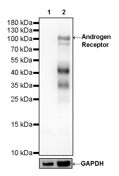 Androgen Receptor Recombinant Rabbit mAb (SDT-R157)