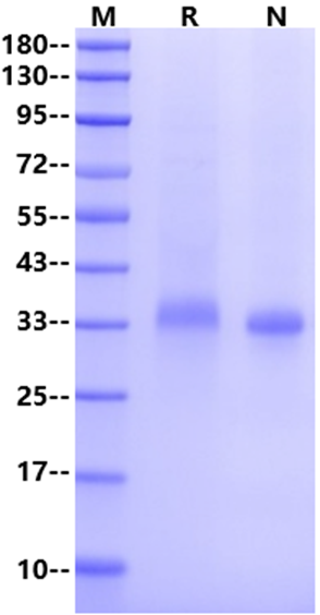 IGFBP-7 His Tag Protein, Human