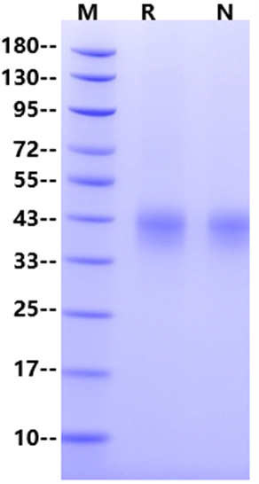 IL-4R alpha/CD124 His Tag Protein, Mouse