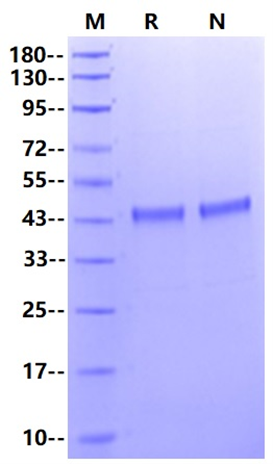 ATG4B His Tag Protein, Human