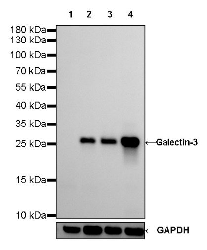 Galectin-3 Recombinant Rabbit mAb (SDT-370-111)
