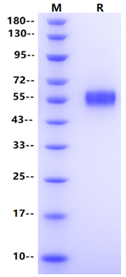 H1N1 HA1 (A/California/04/2009) His Tag Protein