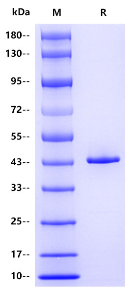HRSV Nucleoprotein , His tag