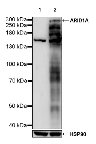 ARID1A Recombinant Rabbit mAb (S-440-27)
