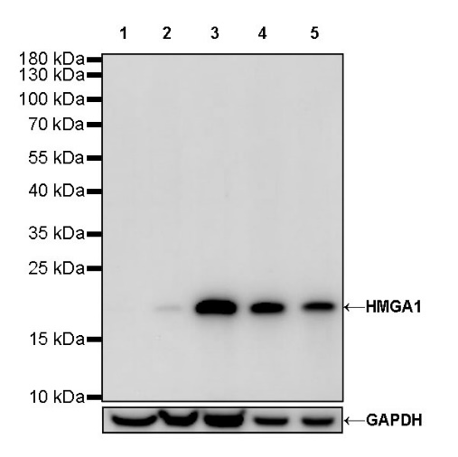 HMGA1 Recombinant Rabbit mAb (S-R332)