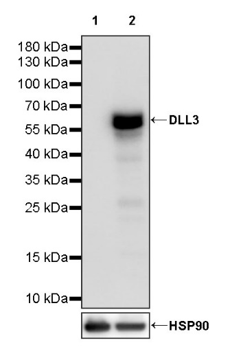 DLL3 Recombinant Rabbit mAb (S-207-179)