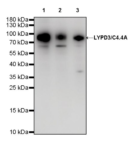 LYPD3/C4.4A Recombinant Rabbit mAb (S-R222)