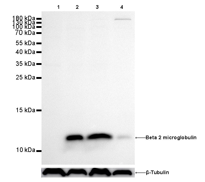 Beta 2 microglobulin Recombinant rabbit mAb (SDT-096-100)