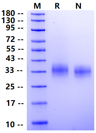 Biotinylated TNFR1/CD120a/TNFRSF1A His&Avi Tag Protein, Human