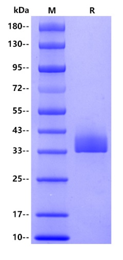 Human HSP70(HSPA1A), His tag