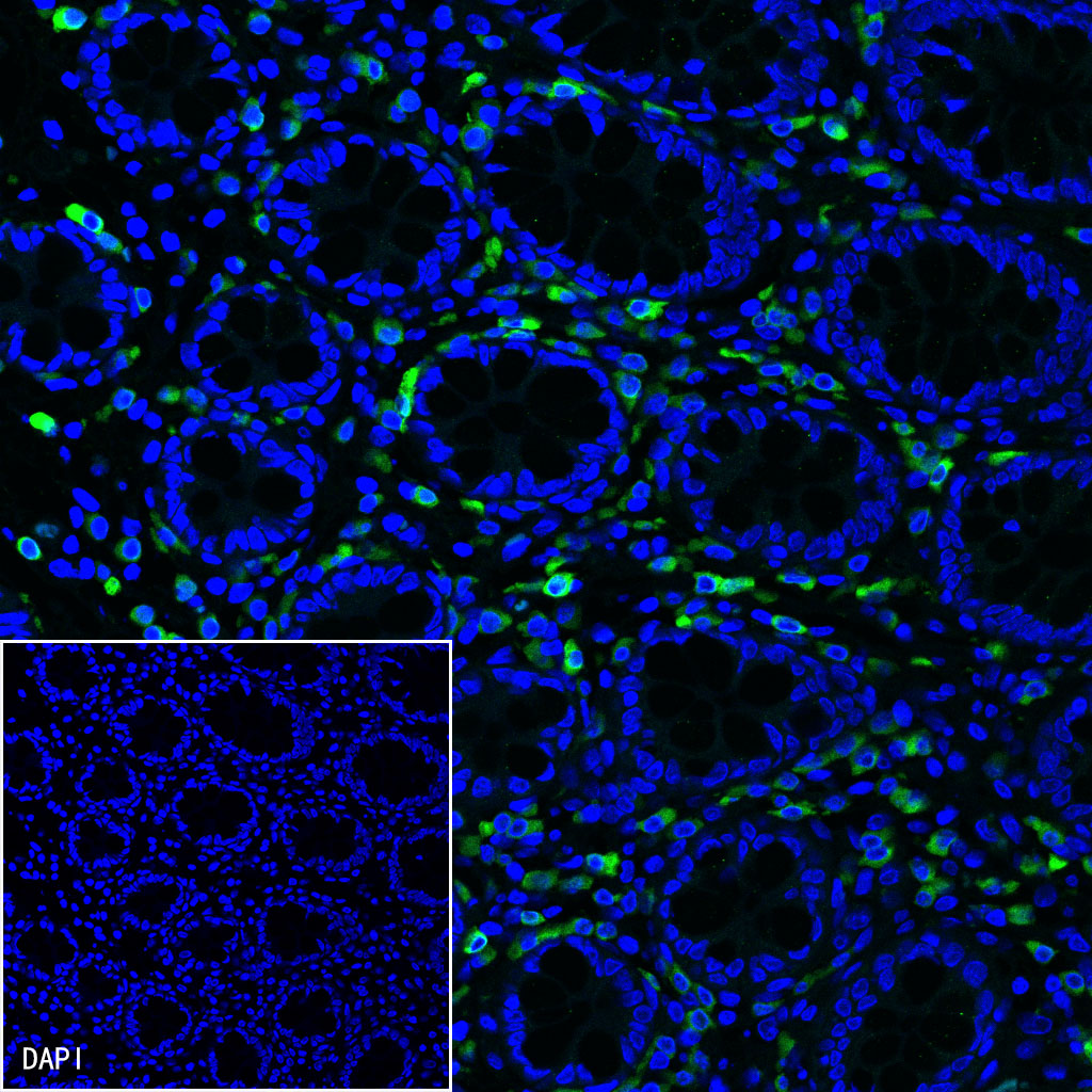 CD79a/MB-1 Recombinant Rabbit mAb (SDT-030-18)