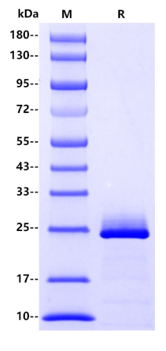 Human FGF19 Protein, His tag