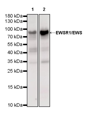 EWSR1/EWS Recombinant Rat mAb (S-R201)