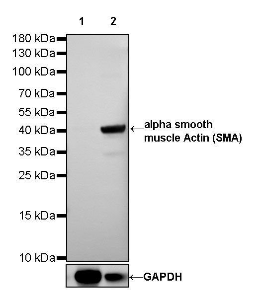 alpha smooth muscle Actin (SMA) Recombinant Rabbit mAb (SDT-132-63)