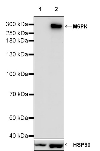 M6PR Recombinant Rabbit mAb (S-1480-21)