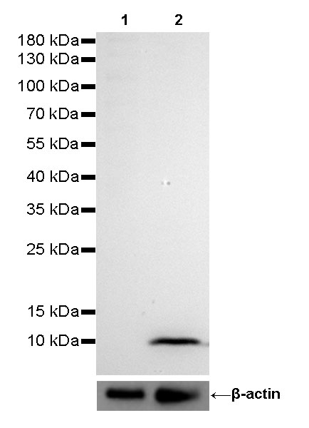 S100A8 (MRP8) Recombinant Rabbit mAb (SDT-059-28)