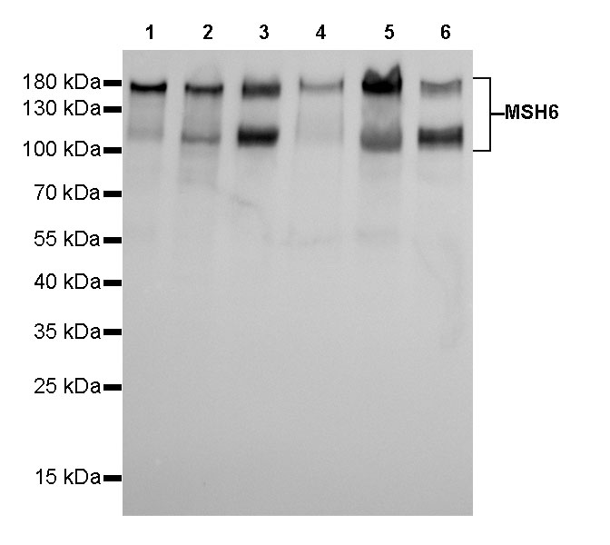 S-RMab® MSH6 Recombinant Rabbit mAb (SDT-R094)