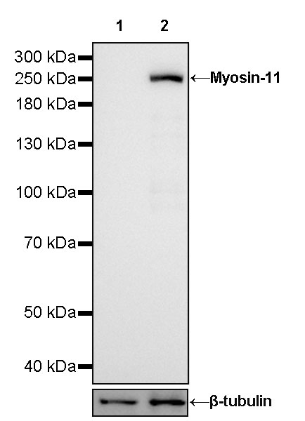 Myosin-11/SMMHC Recombinant Rabbit mAb (SDT-188-112)