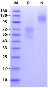 LYPD3 His Tag Protein, Human