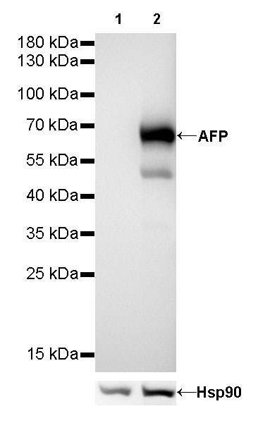 S-RMab® AFP Recombinant Rabbit mAb (SDT-R077)