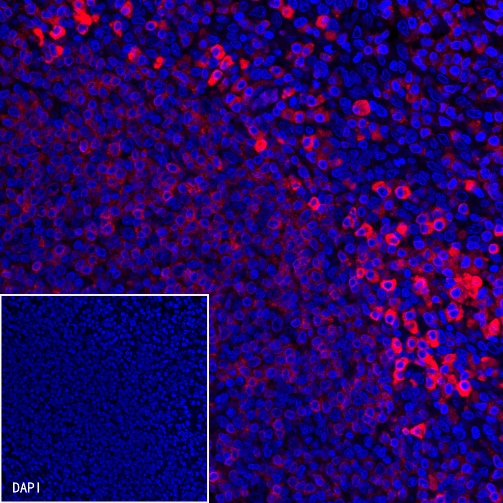 CD79a/MB-1 Recombinant Rabbit mAb (Alexa Fluor® 594 Conjugate) (S-030-18)