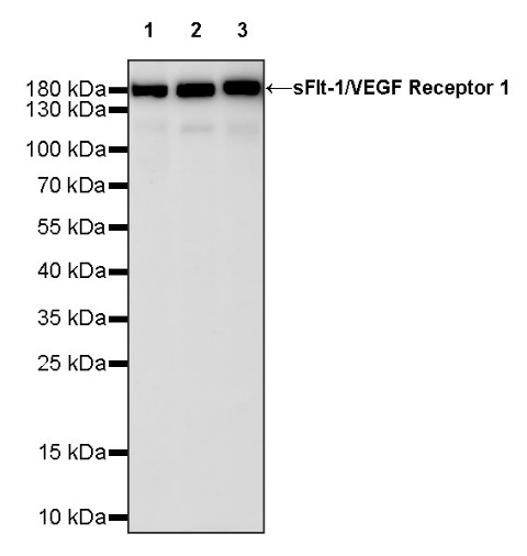 sFlt-1/VEGF Receptor 1 Recombinant Rabbit mAb (S-807-137)